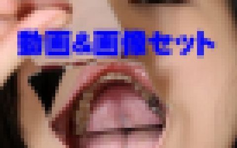 明日奈さんの歯　★★動画＆特典画像★★