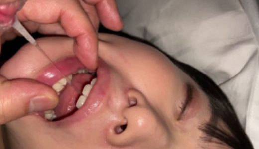 現役JDの透き通る肌と口内炎 ハルナ① KITR00276