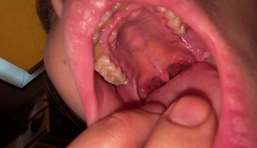 大開帳！歯も舌も喉チ○コも全部見てね コトナ① KITR00279