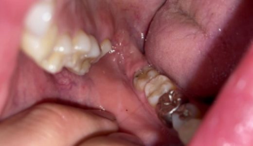 整った歯は嘘でしたｗ近年稀に見るカブセ祭り！！ ナツナ② KITR00282