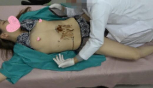 Mr.内科医Ⅱ　秘蔵コレクション（その22　後編）魅惑のバカンスハーフ女子大生
